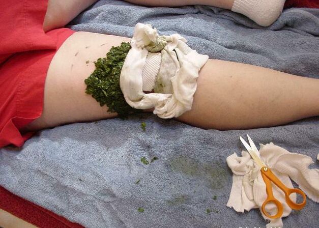 Топла компресија од мелени листови зелка на болен зглоб на коленото со артроза